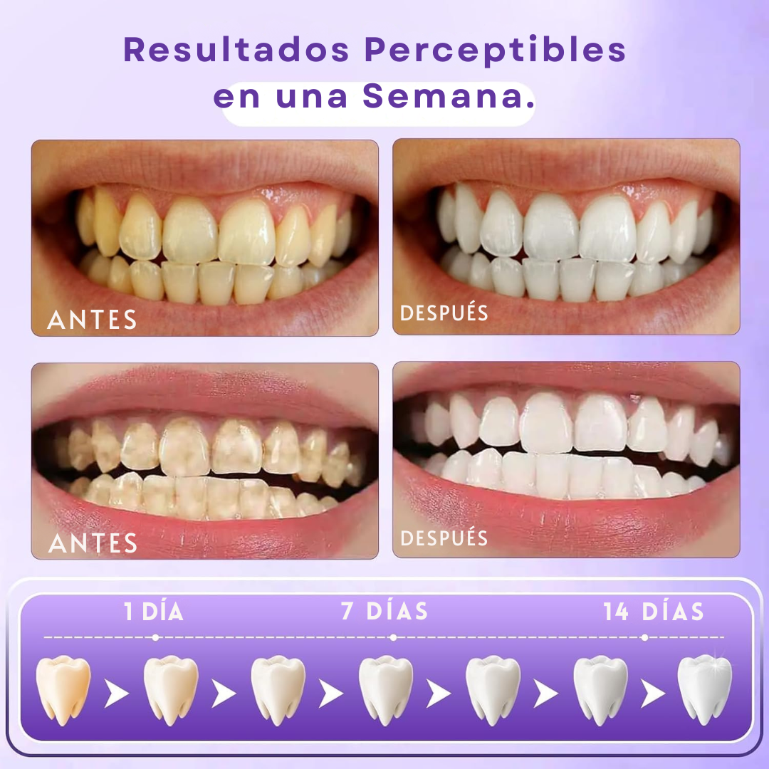NovaSmile | Tiras Blanqueadoras Sin Sensibilidad